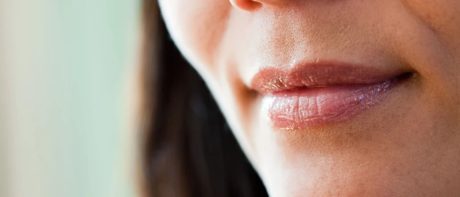 Darkening around the mouth: Causes & Treatment